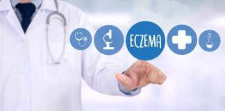Eczema sintomi